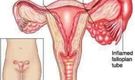 Vagina infection herbs, vaginal lubrication herbs in Soweto+27 71 009 6483